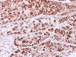 RAB2B Antibody in Immunohistochemistry (Paraffin) (IHC (P))