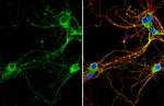 RAB3C Antibody in Immunocytochemistry (ICC/IF)