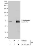 Fibrinogen gamma Antibody in Immunoprecipitation (IP)