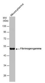 Fibrinogen gamma Antibody in Western Blot (WB)