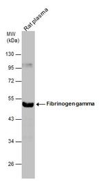 Fibrinogen gamma Antibody in Western Blot (WB)