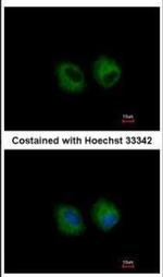 IL1R2 Antibody in Immunocytochemistry (ICC/IF)