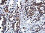 IL1R2 Antibody in Immunohistochemistry (Paraffin) (IHC (P))