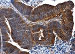 IL1R2 Antibody in Immunohistochemistry (Paraffin) (IHC (P))