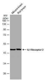 IL1R2 Antibody in Western Blot (WB)