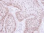 RPA70 Antibody in Immunohistochemistry (Paraffin) (IHC (P))