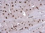 RPA70 Antibody in Immunohistochemistry (Paraffin) (IHC (P))