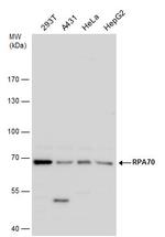 RPA70 Antibody in Western Blot (WB)