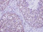 LIMK2 Antibody in Immunohistochemistry (Paraffin) (IHC (P))