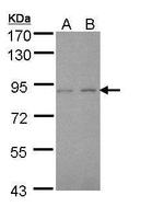 LIMK2 Antibody in Western Blot (WB)