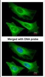 TNNI3K Antibody in Immunocytochemistry (ICC/IF)