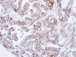 SNTB2 Antibody in Immunohistochemistry (Paraffin) (IHC (P))