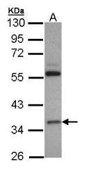 HMGCL Antibody in Western Blot (WB)