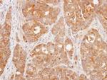 DUSP3 Antibody in Immunohistochemistry (Paraffin) (IHC (P))