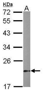 DUSP3 Antibody in Western Blot (WB)