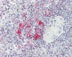 LITAF Antibody in Immunohistochemistry (Paraffin) (IHC (P))