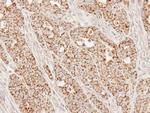 SUCLG1 Antibody in Immunohistochemistry (Paraffin) (IHC (P))