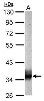 SUCLG1 Antibody in Western Blot (WB)