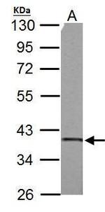 SUCLG1 Antibody in Western Blot (WB)