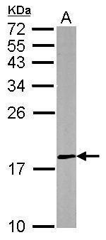 DUSP26 Antibody in Western Blot (WB)