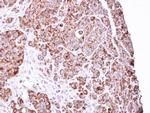 LRP130 Antibody in Immunohistochemistry (Paraffin) (IHC (P))