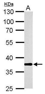 AKR1B10 Antibody in Western Blot (WB)