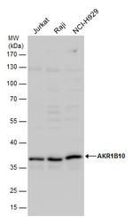 AKR1B10 Antibody in Western Blot (WB)