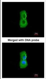 PSMC3 Antibody in Immunocytochemistry (ICC/IF)