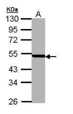 PSMC3 Antibody in Western Blot (WB)