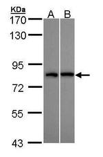 DDX3Y Antibody in Western Blot (WB)