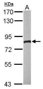 DDX3Y Antibody in Western Blot (WB)