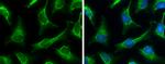 SUCLA2 Antibody in Immunocytochemistry (ICC/IF)