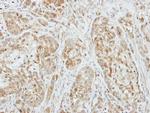 Factor X/Xa Antibody in Immunohistochemistry (Paraffin) (IHC (P))