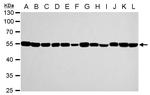 TUBA1A Antibody in Western Blot (WB)