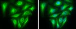 TUBA1A Antibody in Immunocytochemistry (ICC/IF)