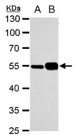 TUBA1A Antibody in Western Blot (WB)