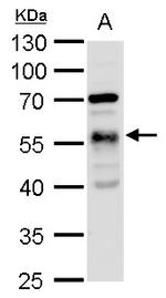 TUBA1A Antibody in Western Blot (WB)