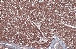 FASN Antibody in Immunohistochemistry (Paraffin) (IHC (P))