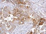 FASN Antibody in Immunohistochemistry (Paraffin) (IHC (P))