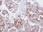 FASN Antibody in Immunohistochemistry (Paraffin) (IHC (P))