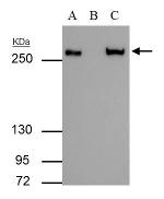 FASN Antibody in Immunoprecipitation (IP)