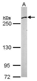 FASN Antibody in Western Blot (WB)