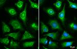 Fumarase Antibody in Immunocytochemistry (ICC/IF)