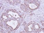 Fumarase Antibody in Immunohistochemistry (Paraffin) (IHC (P))