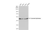 Fumarase Antibody in Western Blot (WB)