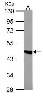 Fumarase Antibody in Western Blot (WB)