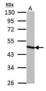 Fumarase Antibody in Western Blot (WB)