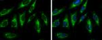 Fumarase Antibody in Immunocytochemistry (ICC/IF)