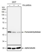 Fumarase Antibody