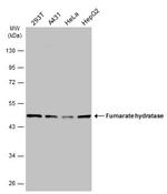 Fumarase Antibody in Western Blot (WB)